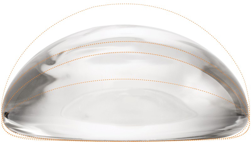 luxe-projection-high