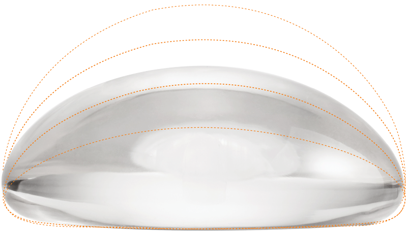 luxe-projection-moderate-plus