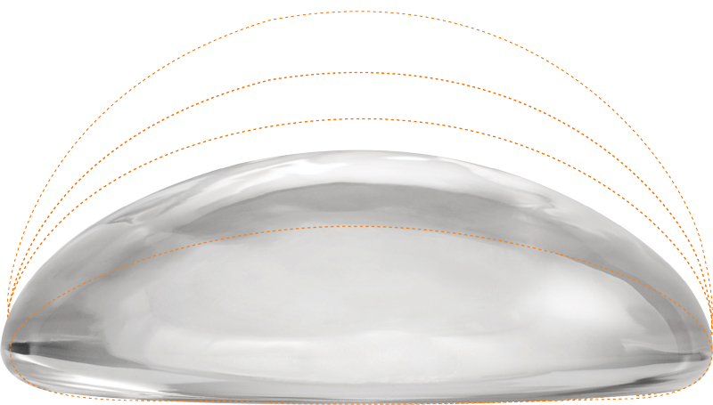 luxe-projection-moderate